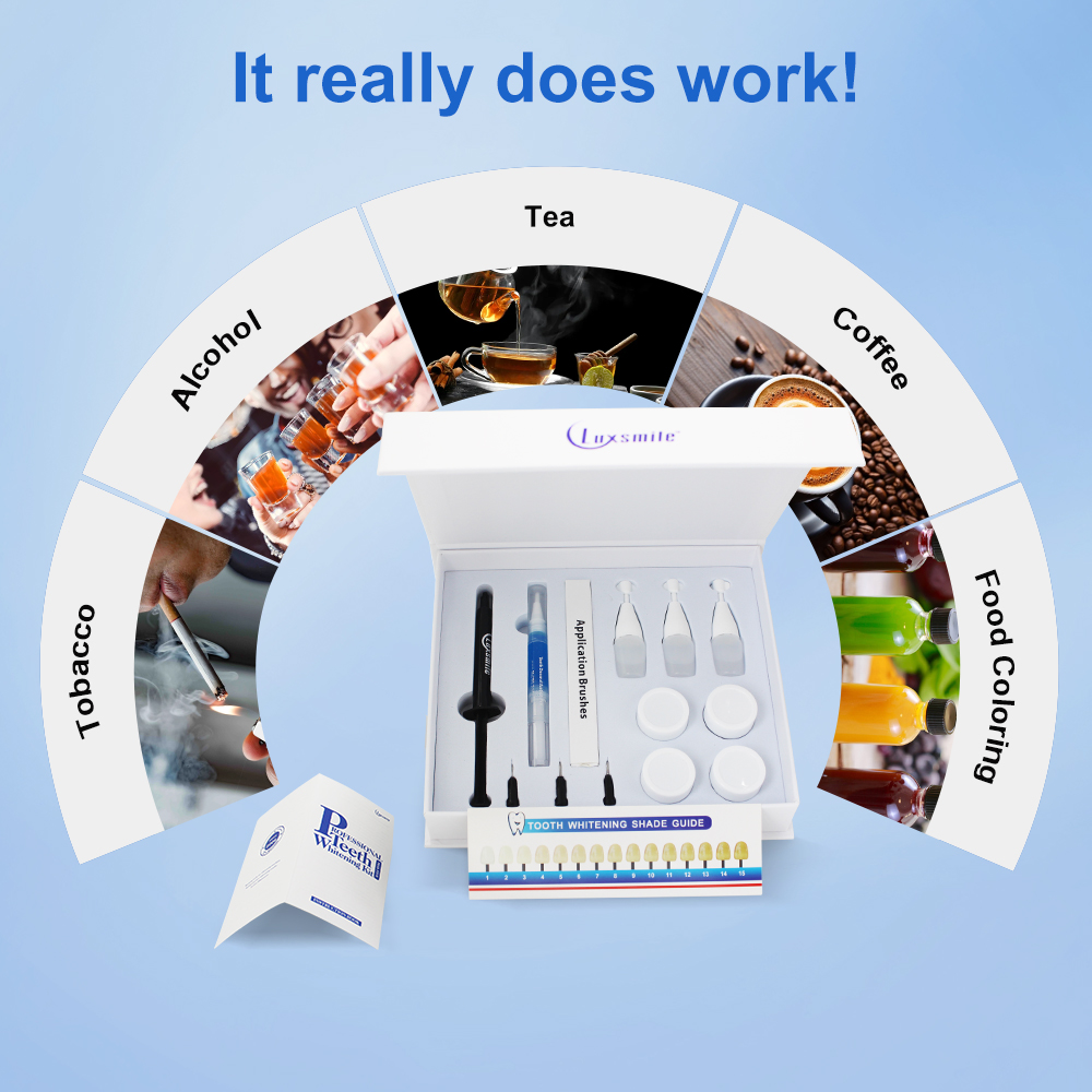 치아 미백 키트 전문 치과 미백제 에이전트 콜드 라이트 - Teeth Whitening Kit At Home 리뷰 및 가격