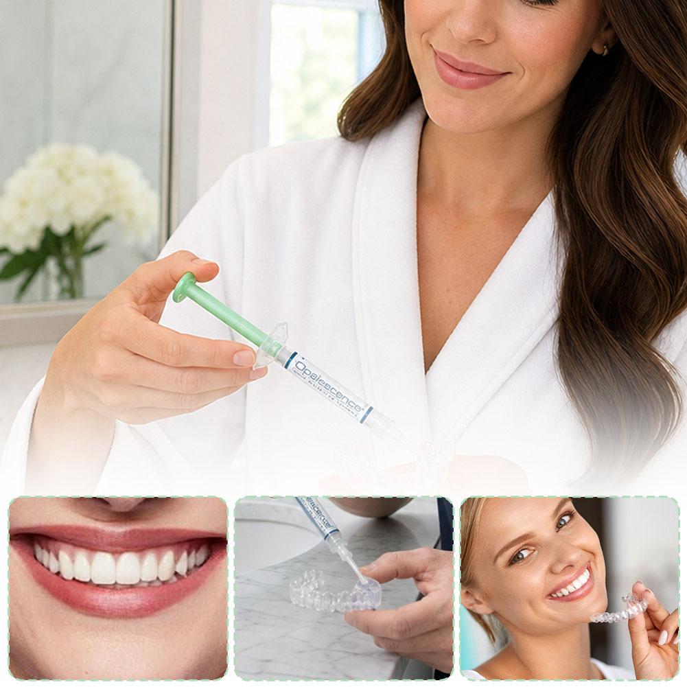 오팔레센스 20% 치아 미백 교체 키트 민트향 치아 시 - Teeth Whitening Kit At Home 리뷰 및 가격