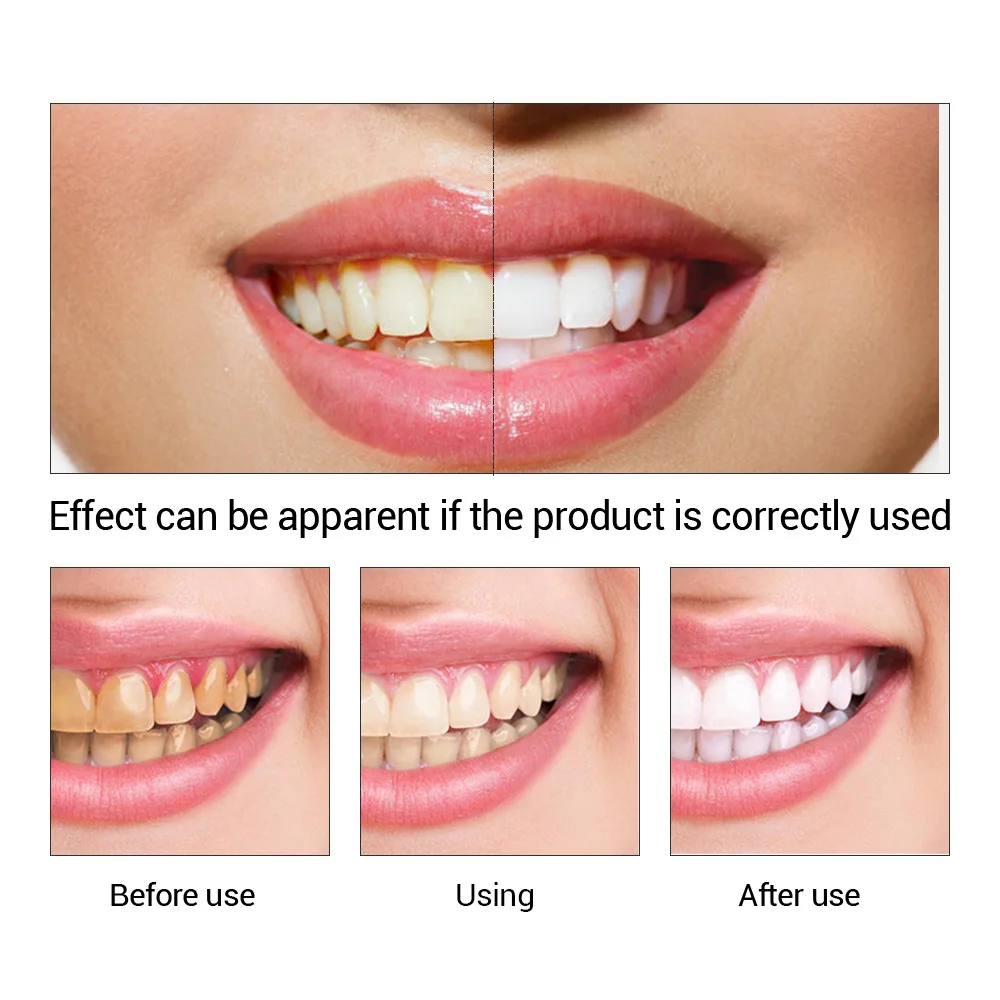 FTEENPLY 치아 미백 에센스 파우더 구강 위생 청 - Teeth Whitening Co 리뷰 및 가격