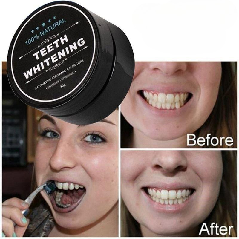 활성탄 치아 미백 파우더 1박스, 숯 치아 클리닝 파우 - Teeth Whitening Co 리뷰 및 가격