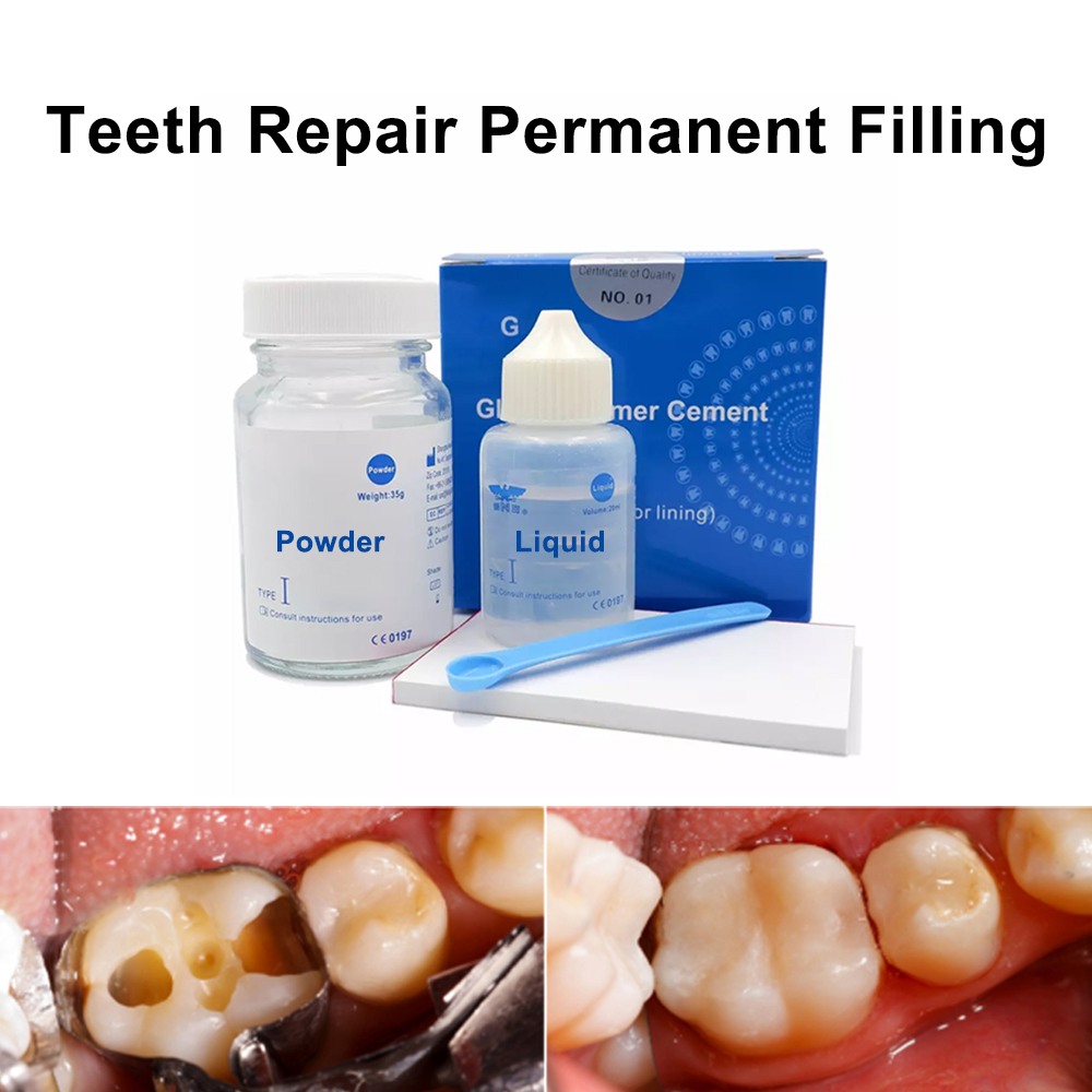 구강 구멍 필러 치아 충치 복원 재료 치과 치료 세트  - Teeth Whitening Kit At Home 리뷰 및 가격
