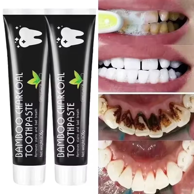 미백 치약 대나무 숯 치약은 구취를 흡수하고 누런 치아 - Teeth Whitening Co 리뷰 및 가격